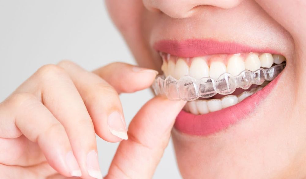 Featured image for “5 Reasons Why Adults Are Choosing Invisalign Over Traditional Braces”